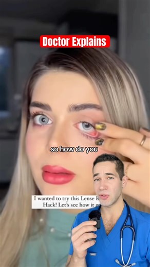 You need to this life hack for contacts!