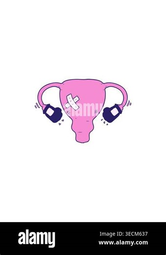 sales flash animation of cartoon beat up uterus with boxing gloves Stock Video Footage - Alamy