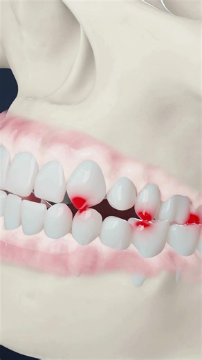Dangers of a Bad Bite