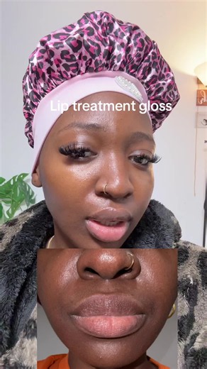 #liptreatment #darklips #lips