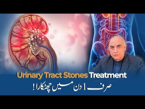 Sirf 1 Din Mein Pathri Se Chutkara - Kidney, Ureter & Bladder Stones Treatment | PCNL & URS Surgery
