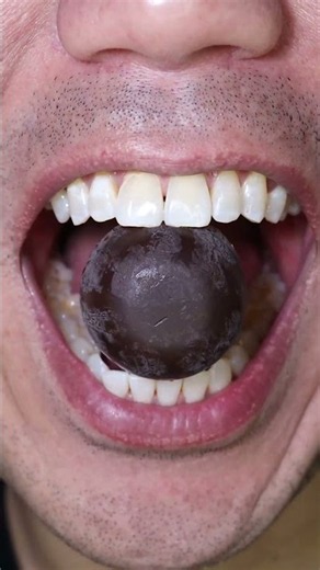 ASMR | Venchi Chocolate #DoctorTristanPeh #ASMR #Chocolate