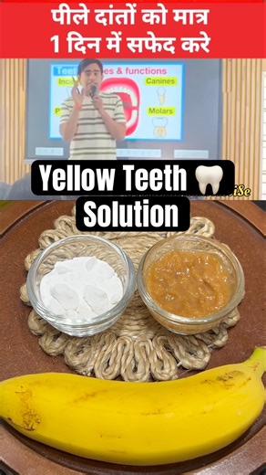 😳 पीले दाँतों को सफेद कैसे करें? | Scientific Method by Vedant Sir #trending #viral #shorts #foryou