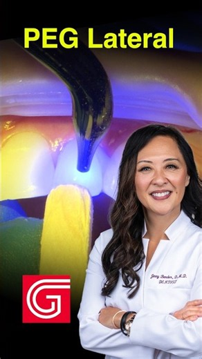 PEG Lateral Crown: WHY I Used Light Cure ONLY Cement #dentistry