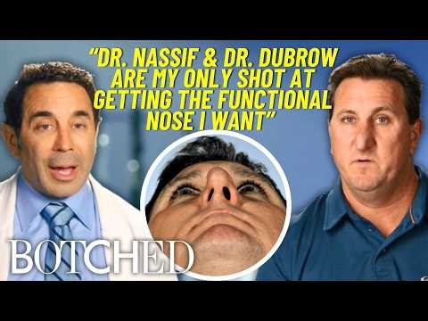 Michael Can Finally Breathe After Botched Rhinoplasty As A Teen *FULL TRANSFORMATION* | Botched | E!