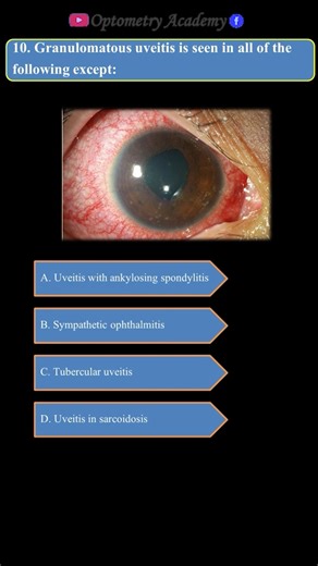 Granulomatous Uveitis