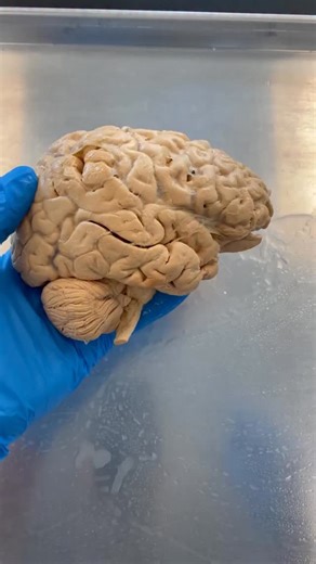 Institute of Human Anatomy in Hindi on Instagram: "Prefrontal Cortex: Impulses ka control center"