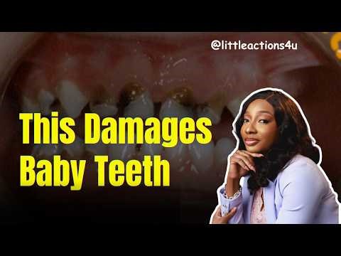 Baby Bottle Rot Explained: How to Protect Your Child’s Teeth Early