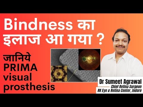 BLINDNESS का इलाज आ गया !?! क्या है PRIMA VISUAL PROSTHESIS ?