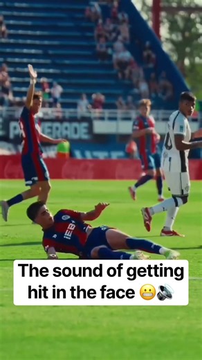 That's going to leave a mark 🤕