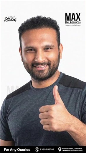 Real people Real growth | best hair transplant clinic in coimbatore , hair loss solution