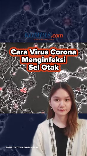 Virus SARS-CoV-2 dan Infeksi Sel Otak Kelelawar