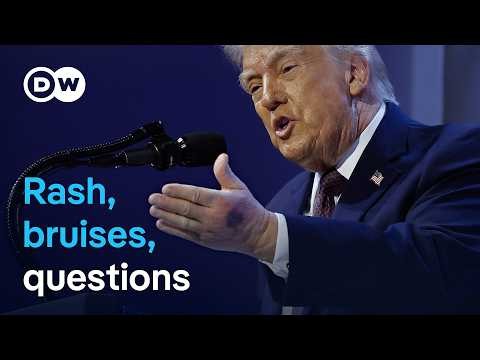 Trump says he's healthy amid new questions over recent images | DW News