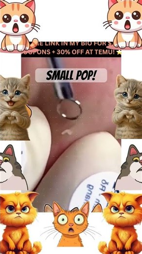 Those blackheads 🤩🤩🤩🤩