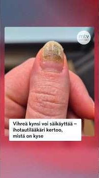 Vihreä kynsi voi säikäyttää – ihotautilääkäri kertoo, mistä on kyse