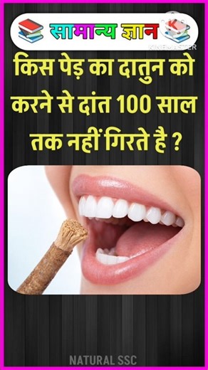 Top 50 ✍️ IAS Question🔥💯🥰 || GK Question and Answer|Part-72| #facts #gkfacts #gkinhindi #staticgk