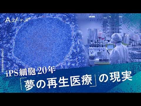 iPS細胞がひっくり返した世界の常識　時計を巻き戻した簡単な方法