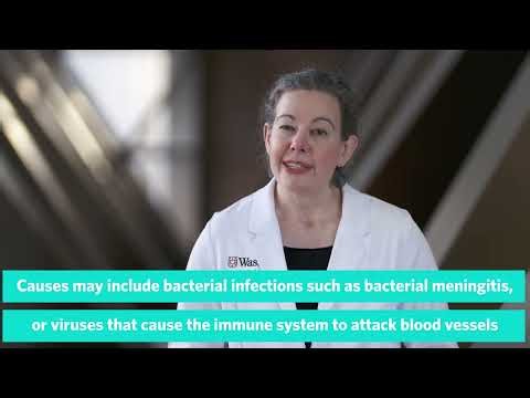 Causes of Stroke in Children