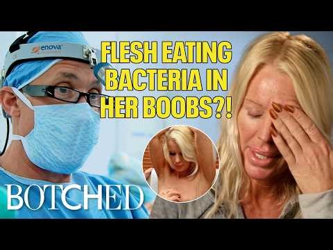 Flesh Eating Bacteria Rotted Away Heather's Boobs and Acting Career (Before & After) | Botched | E!