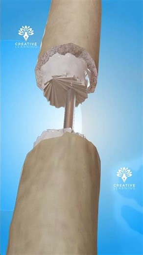 How Height Surgery Actually Works 😨