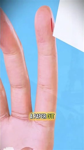 Why Paper Cuts Hurt MORE Than Big Cuts