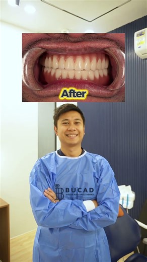 Watch his smile transformation