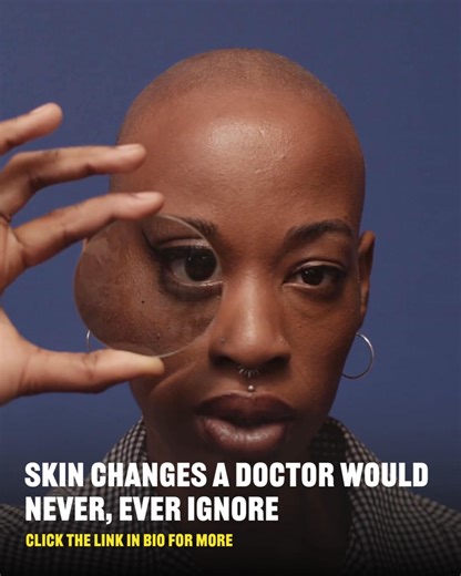 Sudden dryness, rapidly-appearing fine lines, and unexpected dark spots can all warrant investigations, the expert said. More at the link: https://www.buzzfeed.com/aglover/skin-changes-never-to-ingore 🎥: Getty Images | BuzzFeed