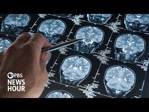 Traumatic brain injuries become defining injury for U.S. troops in post-9/11 conflicts