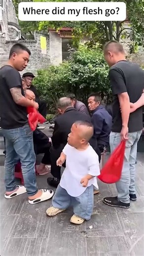 Did the 99cm dwarf’s flesh turn into water? #Laugh #Funny #Dwarf #99cm