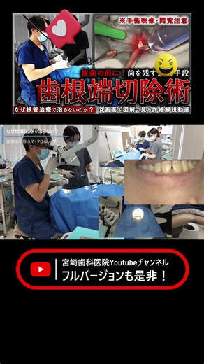 【手術映像・閲覧注意】なぜ根管治療で治らない？抜歯の前の最終手段『歯根端切除術』 マイクロスコープとエルビウムヤグレーザーによる４画面+図解で見る詳細解説 #宮崎歯科医院