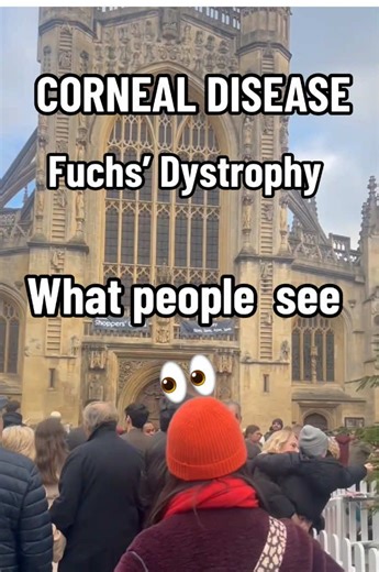 Understanding Fuchs Dystrophy and Corneal Diseases