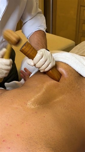 Professional cupping session 🔥 #cupping #therapy #tutorial