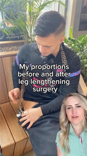 This surgery made him taller?!