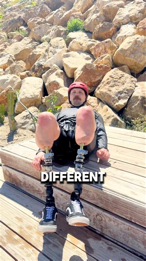 This Guy’s Prosthetic Legs Are Insane!