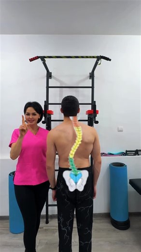 verginia center on Instagram: "Gentle spinal decompression may be used as a supportive element of exercise therapy for scoliosis to reduce spinal compression and improve mobility. ⚠️ Do not perform if there is pain. Avoid aggressive or prolonged hanging. Dr. Marina Ispiryan Founder of Verginia Center 📍 Armenia | Online & Offline 📲 WhatsApp: +374 98 149914 #scoliosis #scoliosistreatment #spinalhealth #spinaldecompression #physiotherapy rehabilitation exercisetherapy VerginiaCenter"