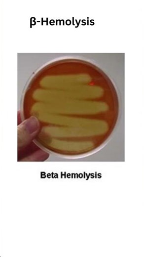 Hemolysis on Blood Agar 🔬 | Alpha Beta Gamma Explained | Microbiology Practical