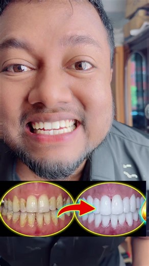 Why Choose Sensodyne Toothpaste for Sensitive Teeth