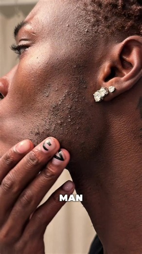 What Is on My Face? How to Identify & Fix Common Skin Issues