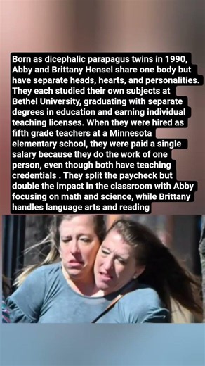 Conjoined Twins Earned Two Degrees But Shared One Teacher's Salary