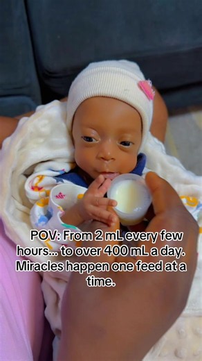 From 2 mL feeds in the NICU to 400 mL every day. 🥹 Every drop once felt like a victory. Watching Jasmine grow stronger has been the greatest blessing. Thank you to everyone who’s been praying, encouraging, and following her journey. Please keep her in your prayers as we celebrate every little milestone. 💕🙏 #PreemieStrong #NICUJourney #BabyJasmine #PrematureBaby #GrowthJourney