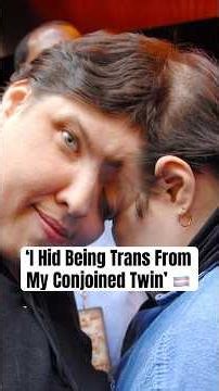 ‘I Hid Being Trans From My Conjoined Twin’ #shorts #viralcouple #conjoinedtwin
