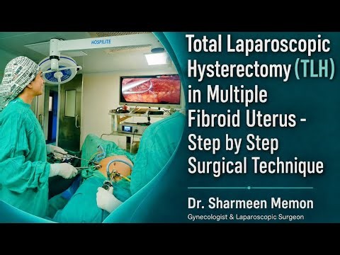 Total Laparoscopic Hysterectomy (TLH) in Multiple Fibroid Uterus| Step-by-Step Surgical Procedure