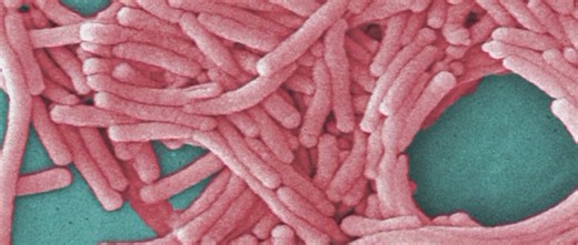 Outbreak of Legionnaires' disease hits Upper East Side of Manhattan