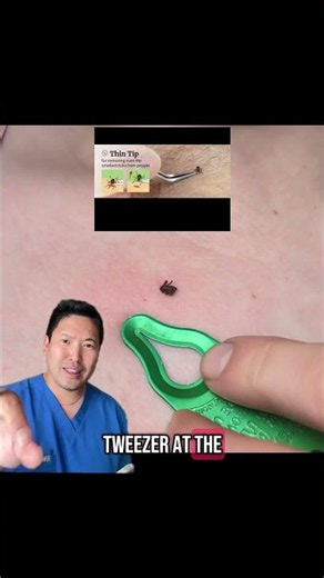 Dermatologist Reacts to Tick Removal Tool