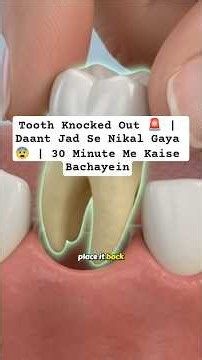 Tooth Knocked Out 🚨 | Daant Jad Se Nikal Gaya 😨 | 30 Minute Me Kaise Bachayein