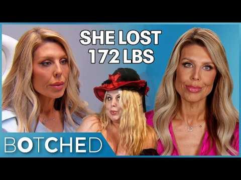 Christina Lost 172 Pounds and Her Boob Job Ruined Her Confidence All Over Again | Botched | E!