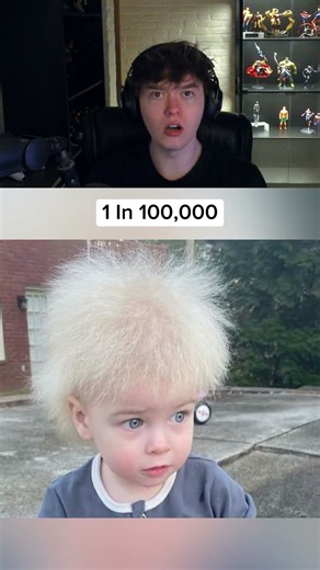 RAREST HUMAN GENETICS!!
