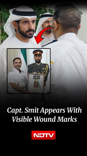 Captain Smit Machchhar Honoured: Flydubai Pilot Appears With Visible Head Wounds During MBZ Meet