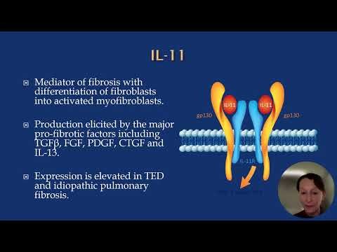 A Practical Algorithm for the Use of Biologics for Thyroid Eye Disease (TED)