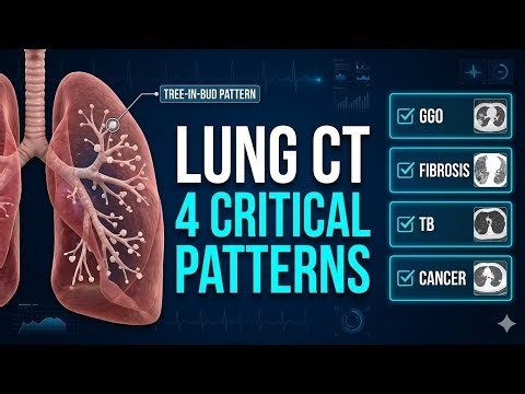 Mastering Lung CT Interpretation | Identifying 4 Major Patterns 🫁🩺